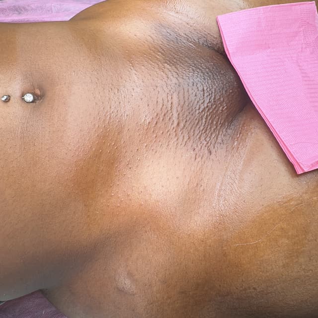 The Clear Skin Club at Poised Beauty Parlor,LLC in Clinton Township, MI